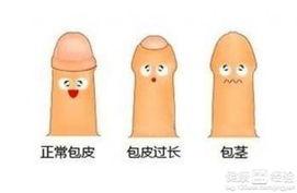 成人包包皮包扎视频